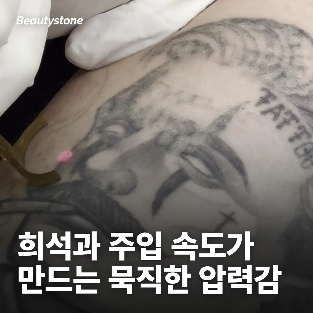 두 번째 갈래: 약이 퍼질 때의 묵직함