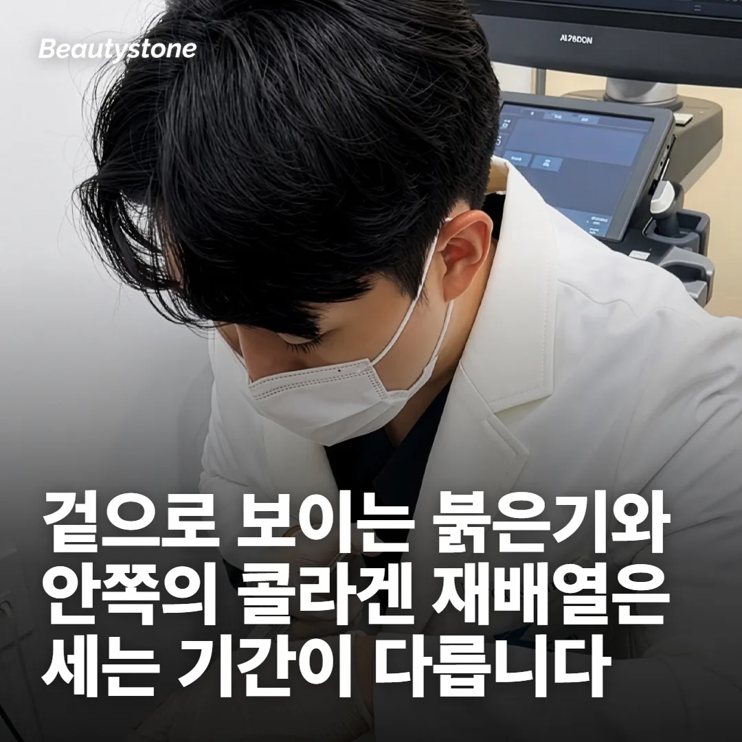 올리지오 다운타임, 어느 기간을 세는 말인지부터 갈라요
