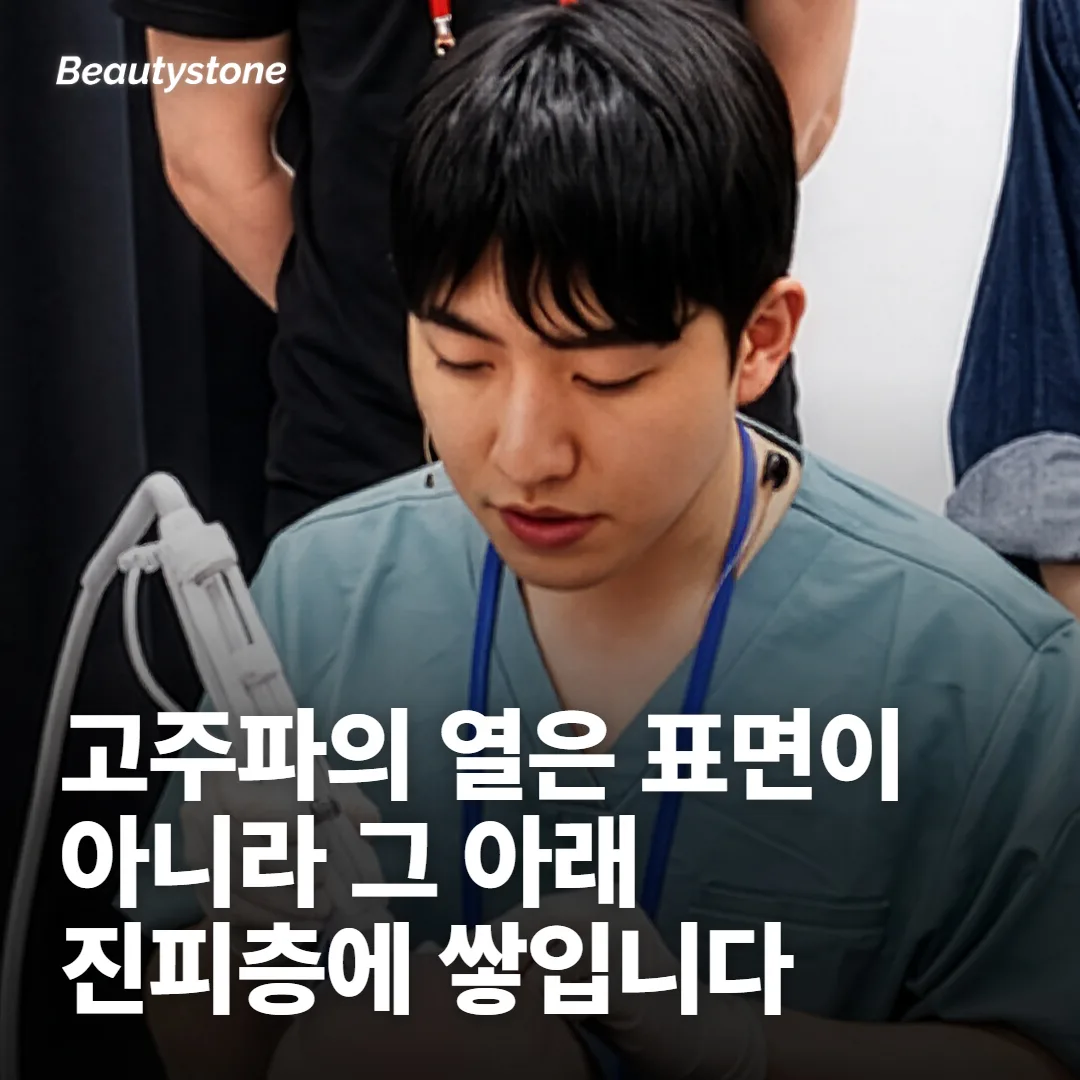 올리지오 고주파는 표면이 아니라 진피를 데우는 방식입니다