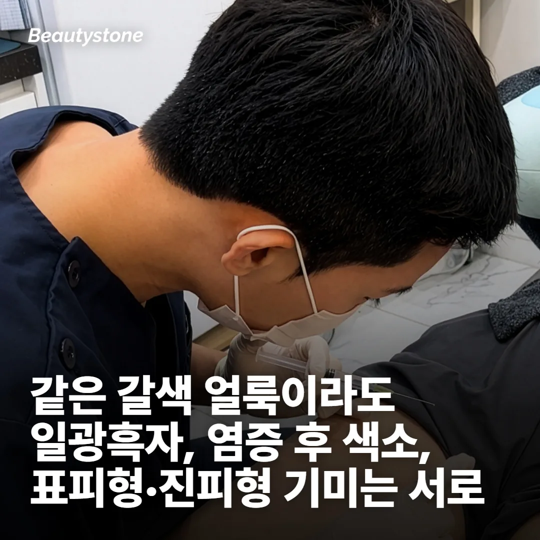 후기가 극과 극인 첫 번째 이유, 같은 기미가 아니었어요