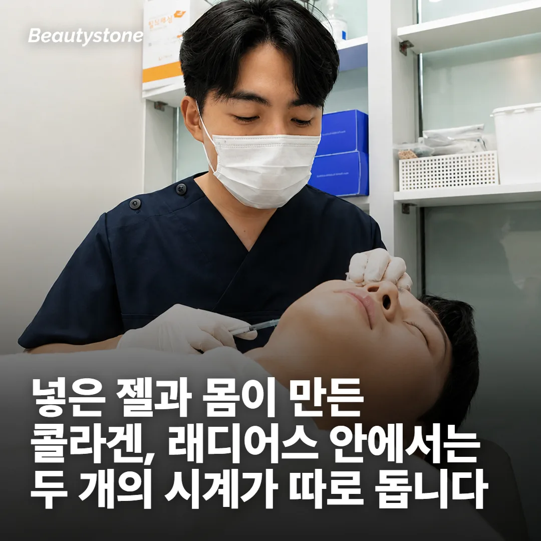 래디어스 주기가 한 줄로 정리되지 않는 이유