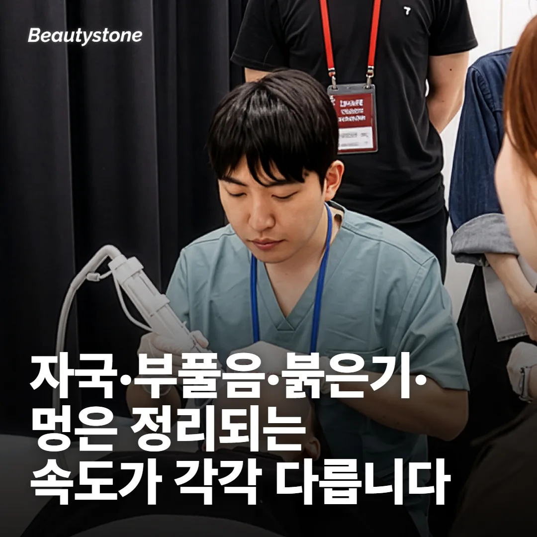 리쥬란 다운타임은 며칠이 아니라 무엇이 남았는지로 셉니다