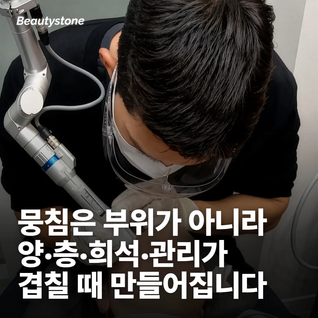 노듈은 부위가 아니라 조건에서 생깁니다
