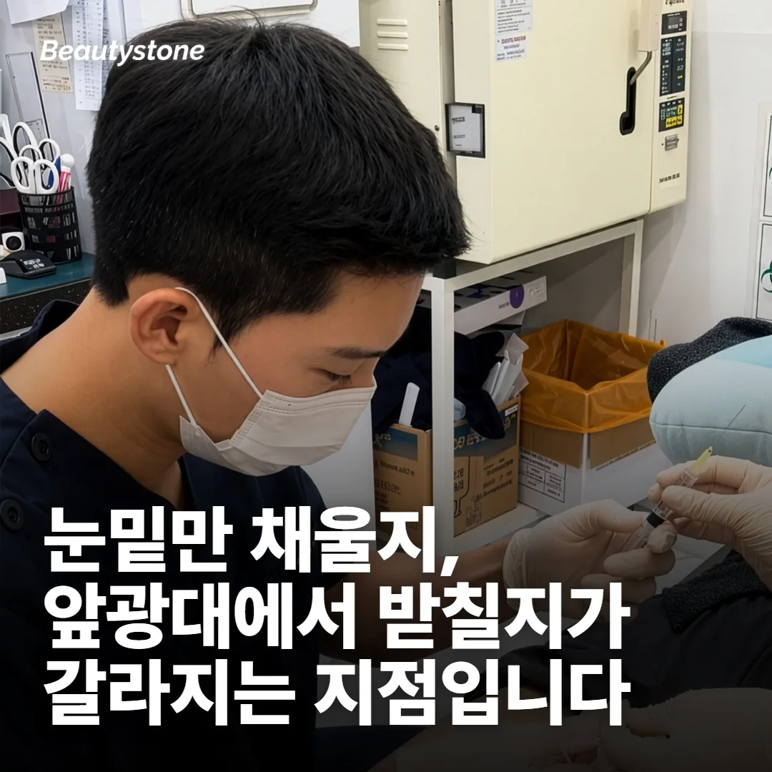 눈밑만 보면 오히려 티가 나는 경우