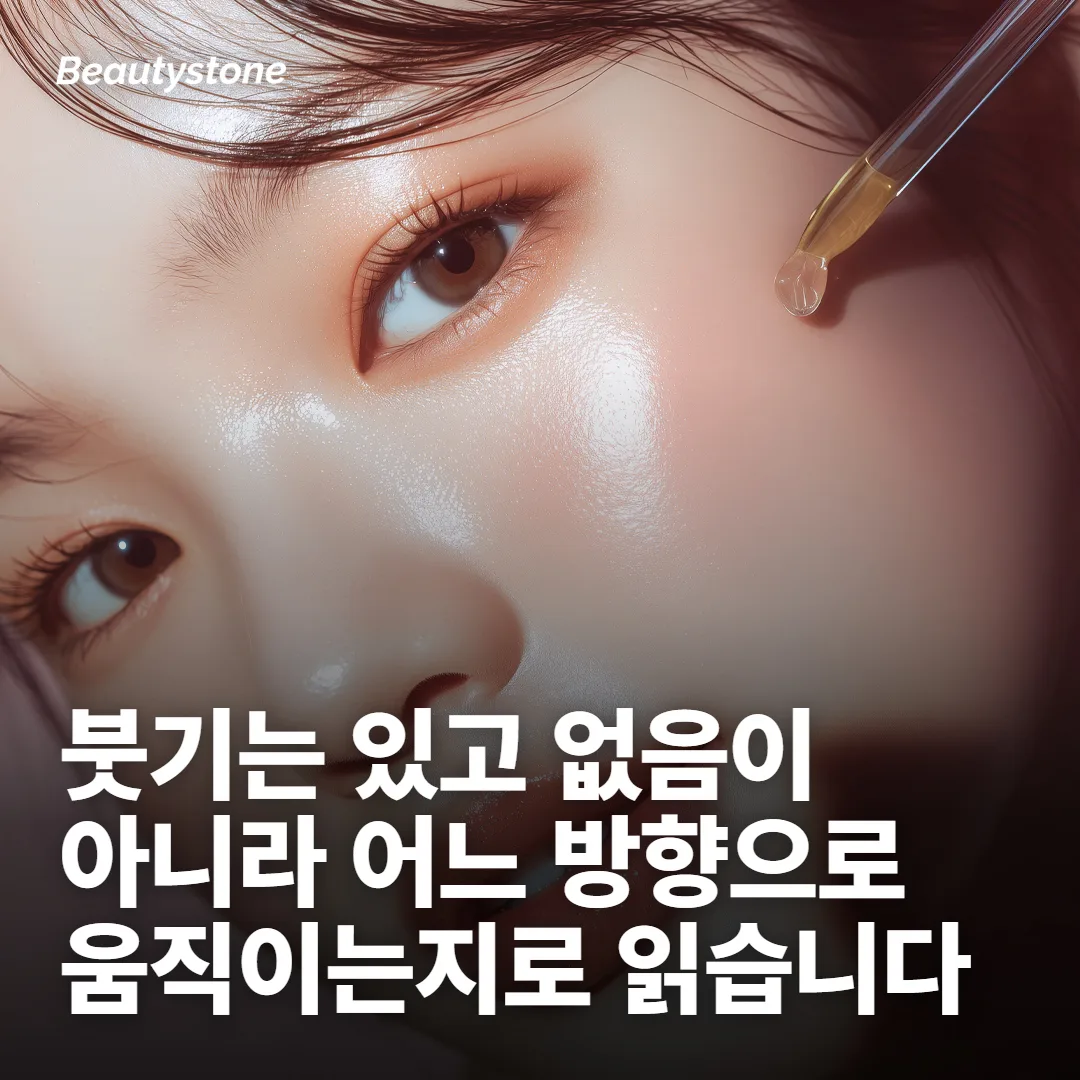 여드름이 붓는 건 염증이 일을 시작했다는 뜻입니다