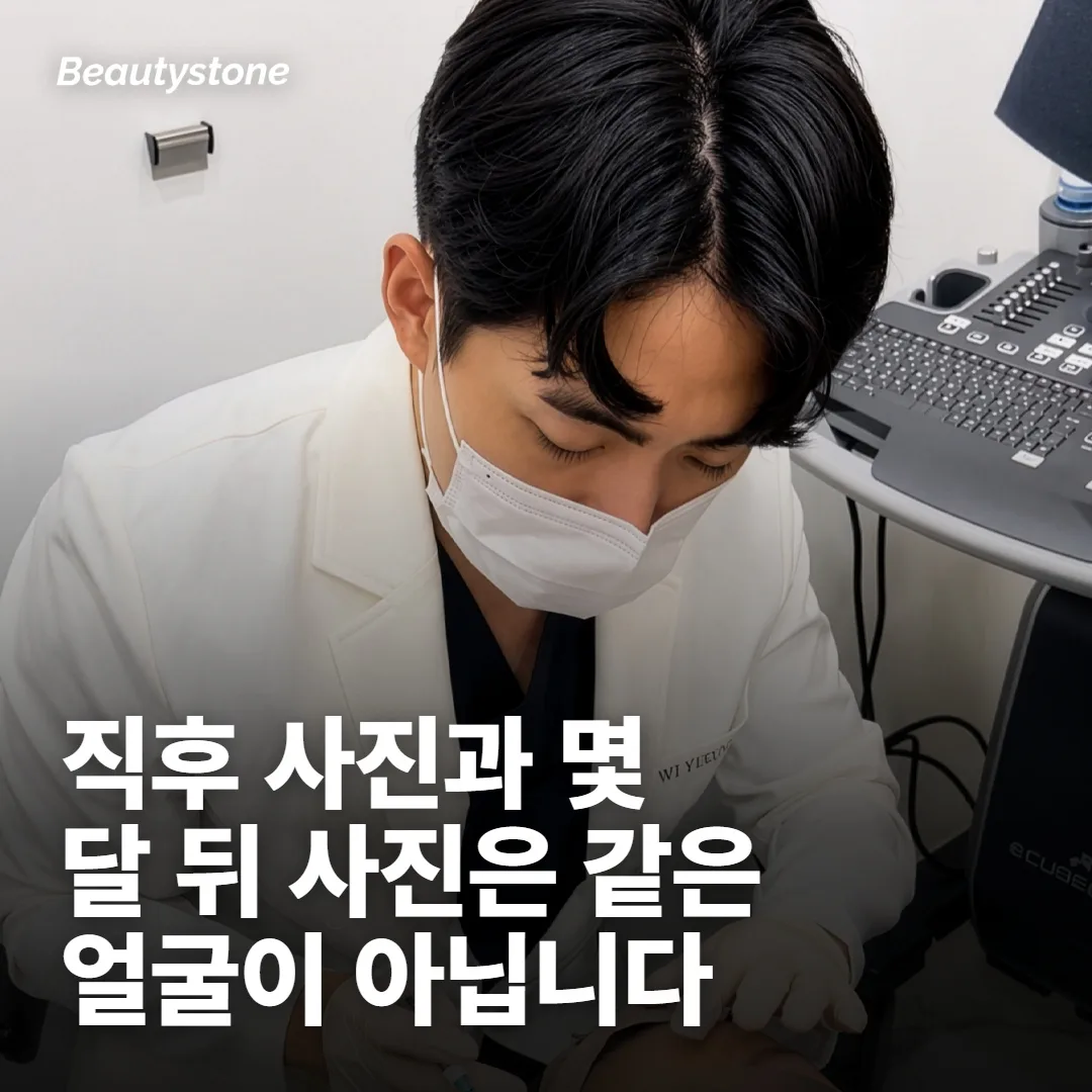 시점 — 언제 찍었는지가 남은 절반입니다