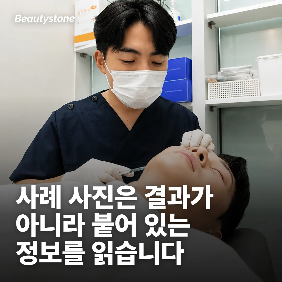부작용 사례 사진은 이렇게 갈라 봅니다