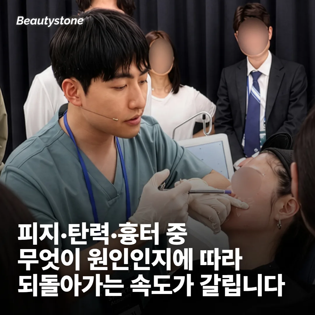되돌아가는 속도는 원인이 남아 있는지에 달립니다