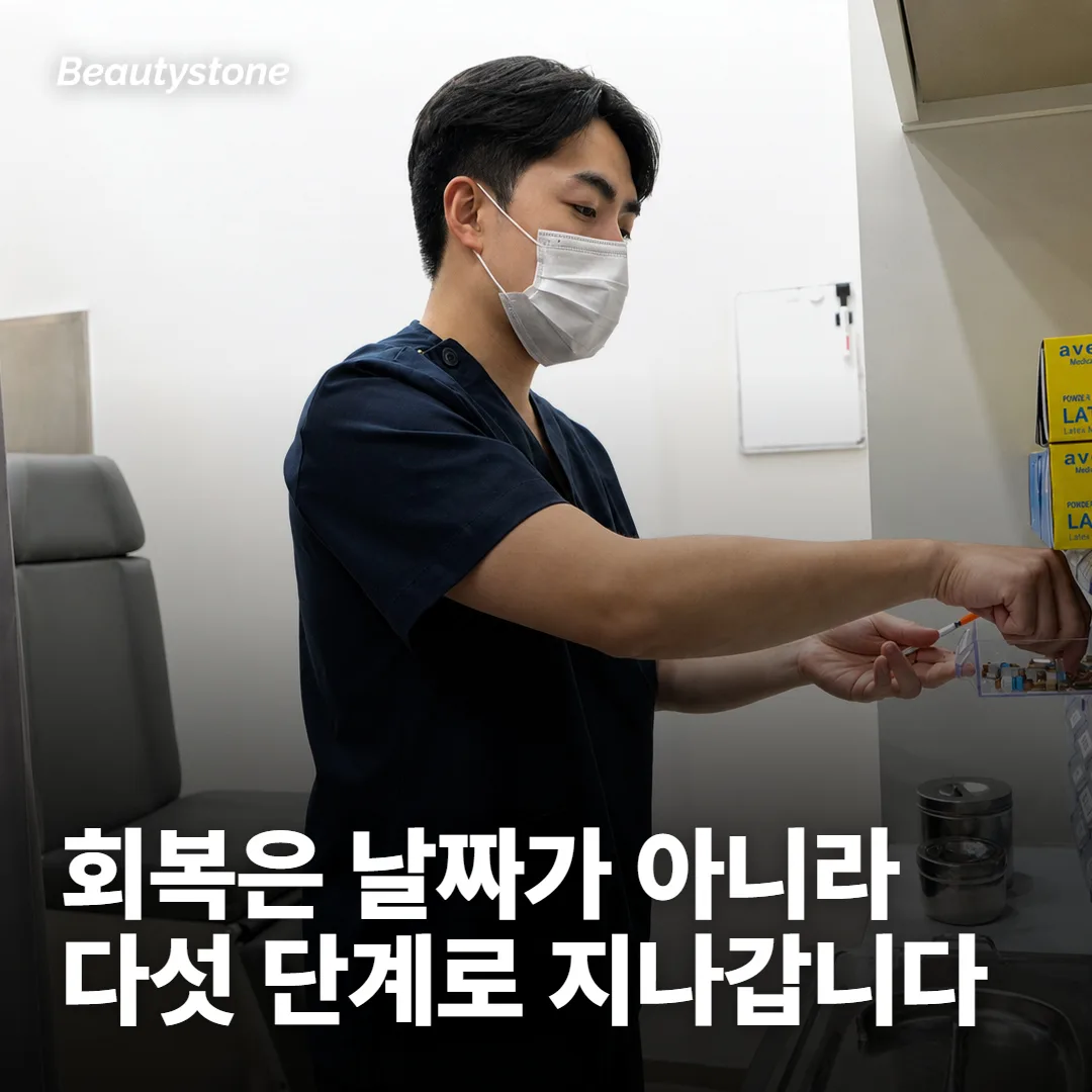 프락셀 다운타임은 날짜가 아니라 단계로 갈려요