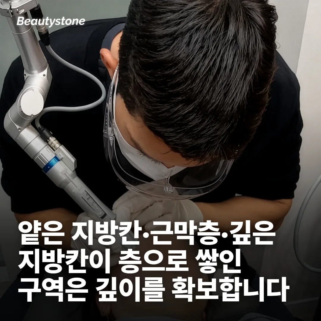 광대 아래 볼은 층이 여러 겹이에요