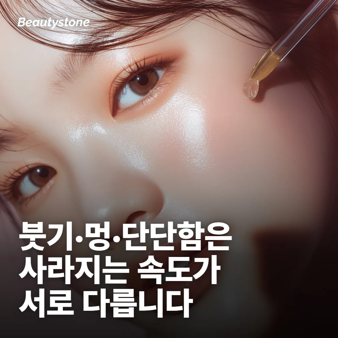 레디어스가 남기는 자국은 성격이 다른 세 가지
