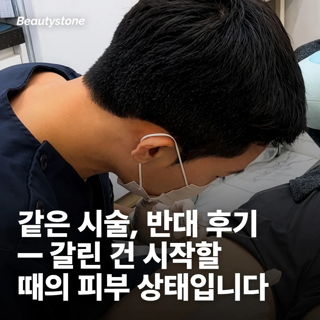 같은 시술인데 후기가 갈리는 건 출발점이 달라서예요