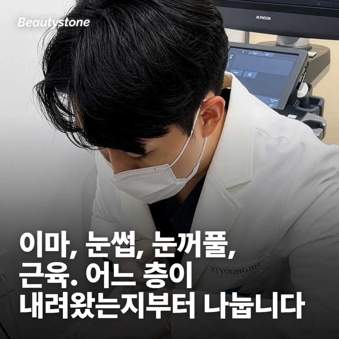 답답한 눈매는 어느 층이 내려왔는지로 갈립니다