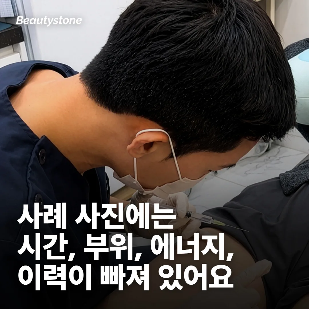 소프웨이브 부작용 사진을 먼저 봤다면, 빠진 정보가 있어요