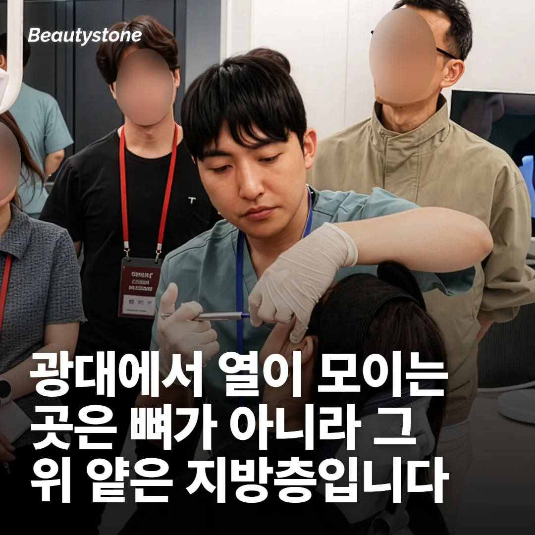 온다 광대, 열이 닿는 자리는 피부가 아니에요
