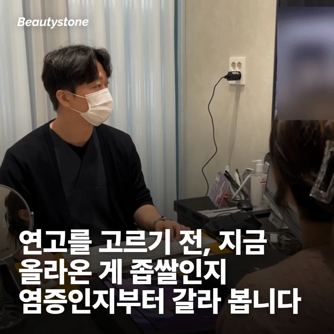 여드름연고는 개수가 아니라 종류를 보고 고릅니다
