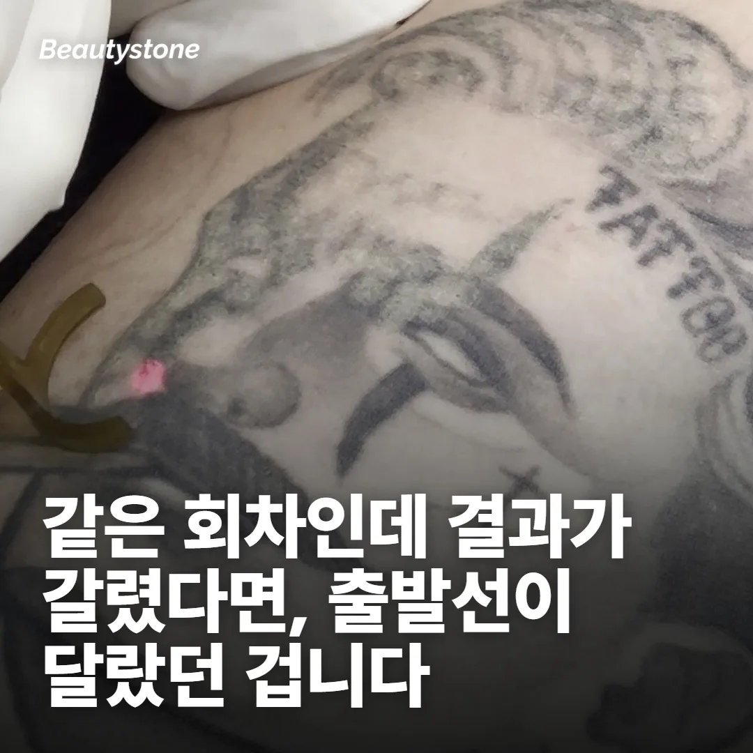 후기가 엇갈리는 건 사람이 달라서가 아니라 조건이 달라서예요
