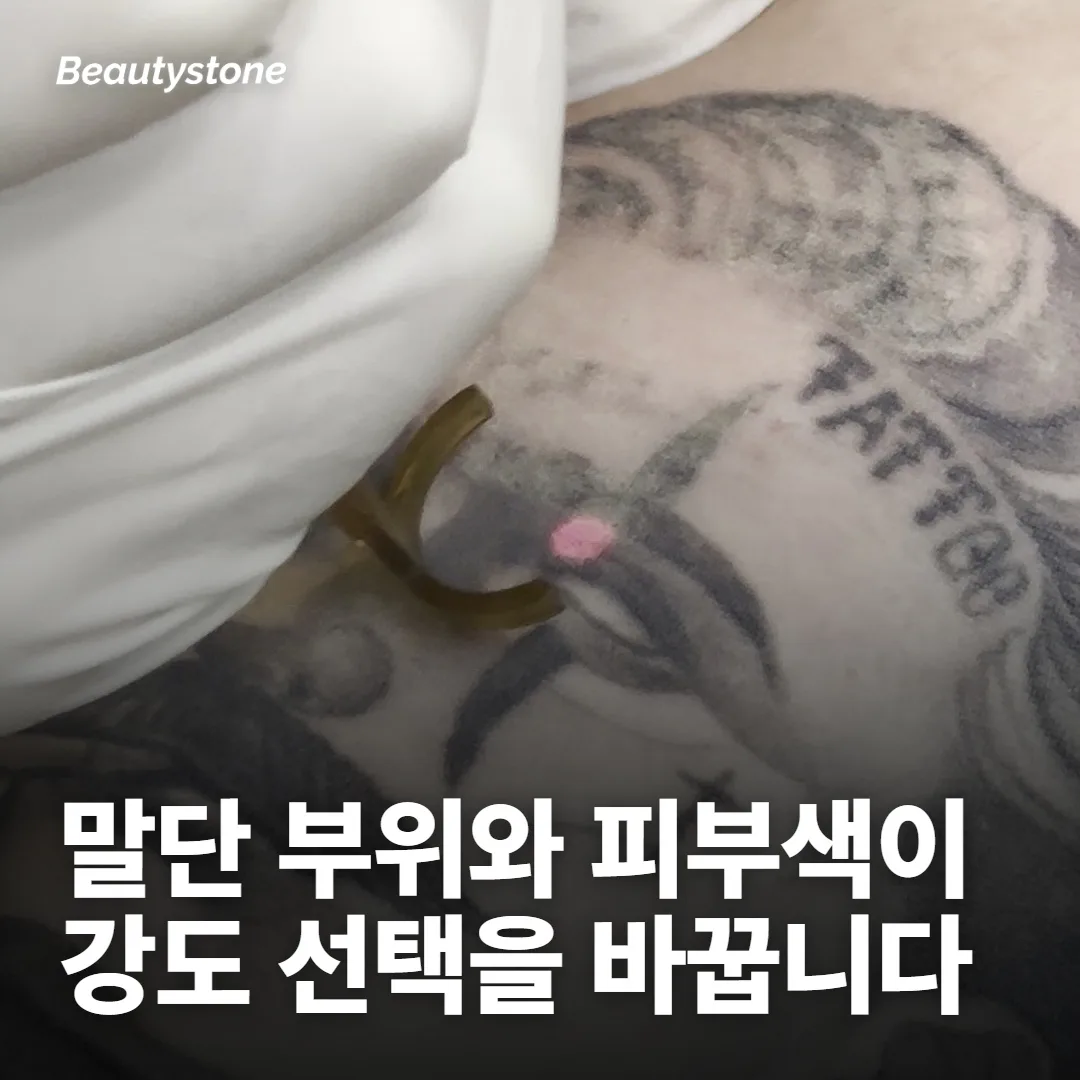 부위와 회복 반응이 같은 강도를 다르게 만듭니다
