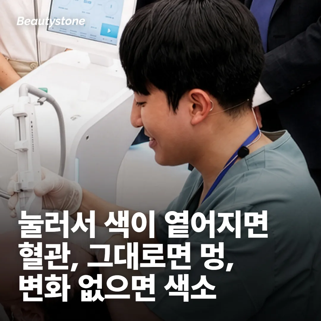 멍인지 붉은 자국인지 갈색 자국인지 갈라 보세요