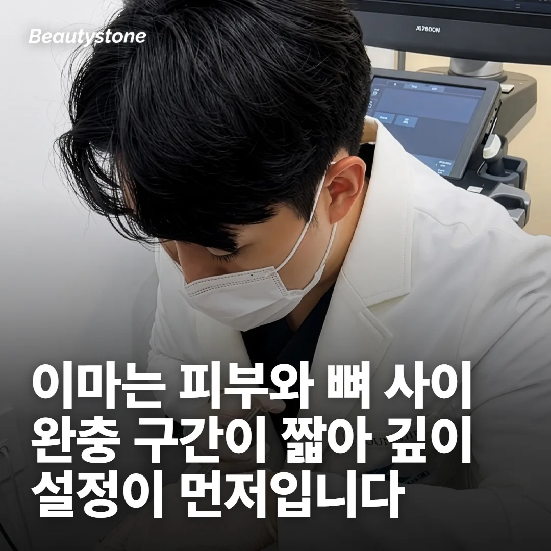 이마는 완충 구간이 짧은 부위입니다