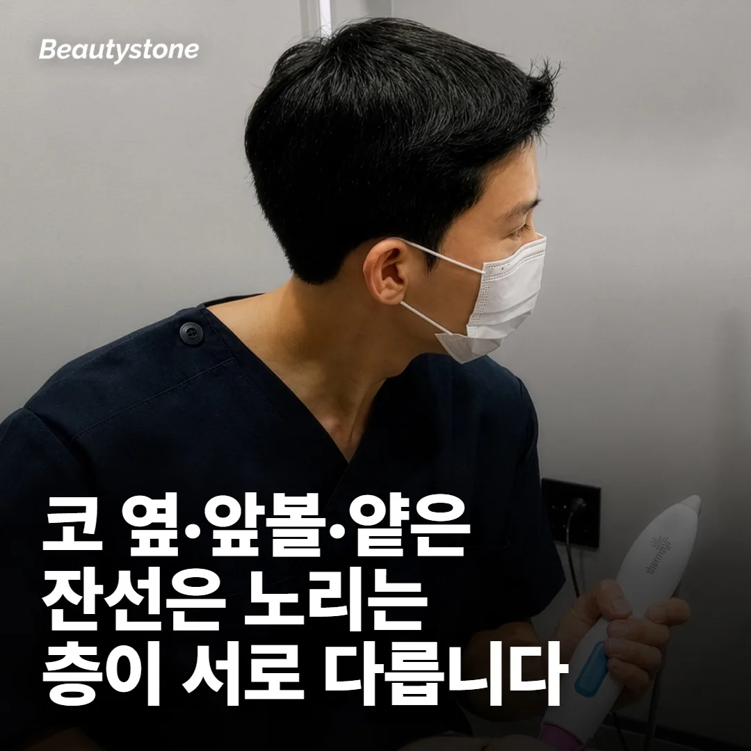 같은 엘란쎄인데 부위마다 설계가 달라지는 이유
