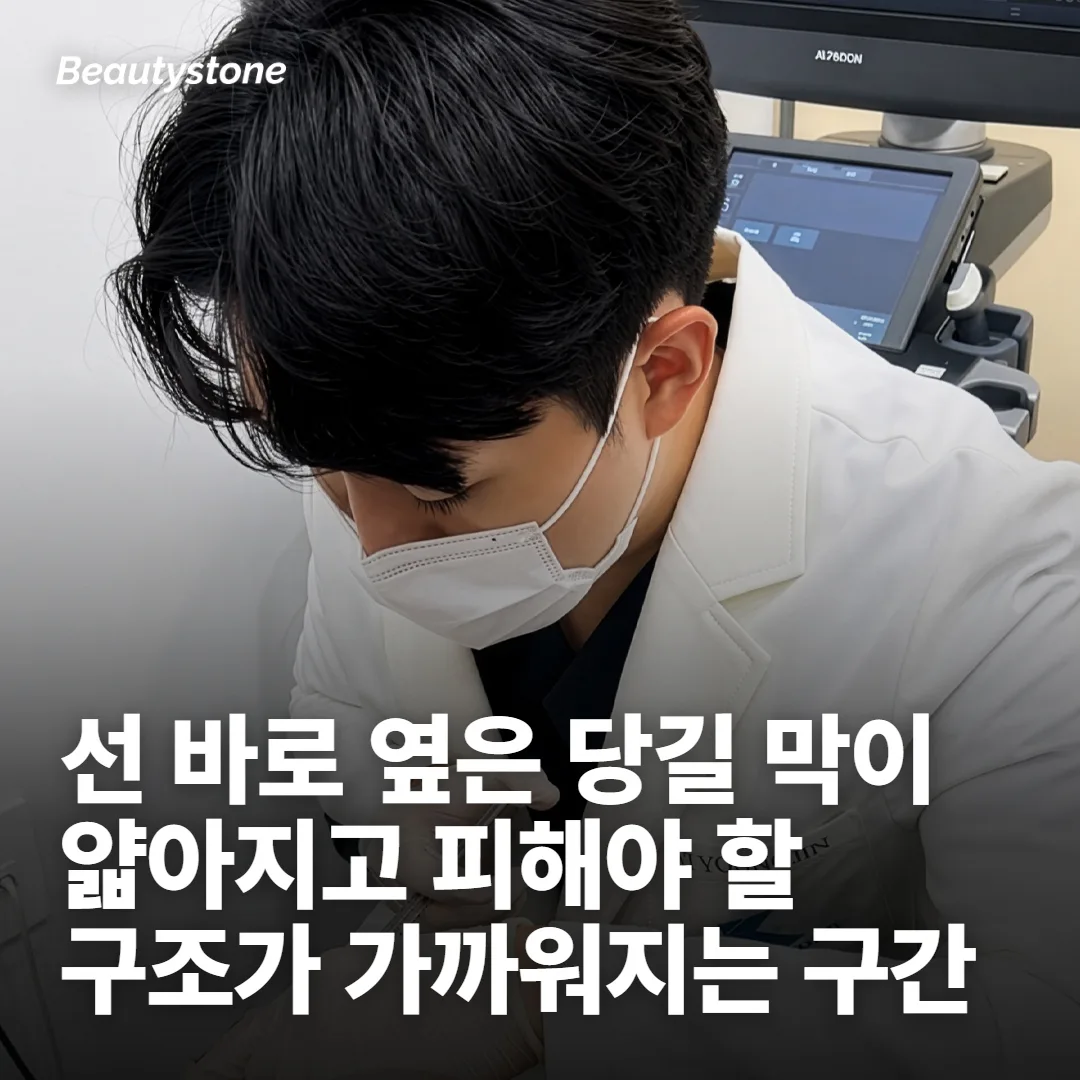 팔자 선 바로 옆에는 당길 막이 마땅치 않아요
