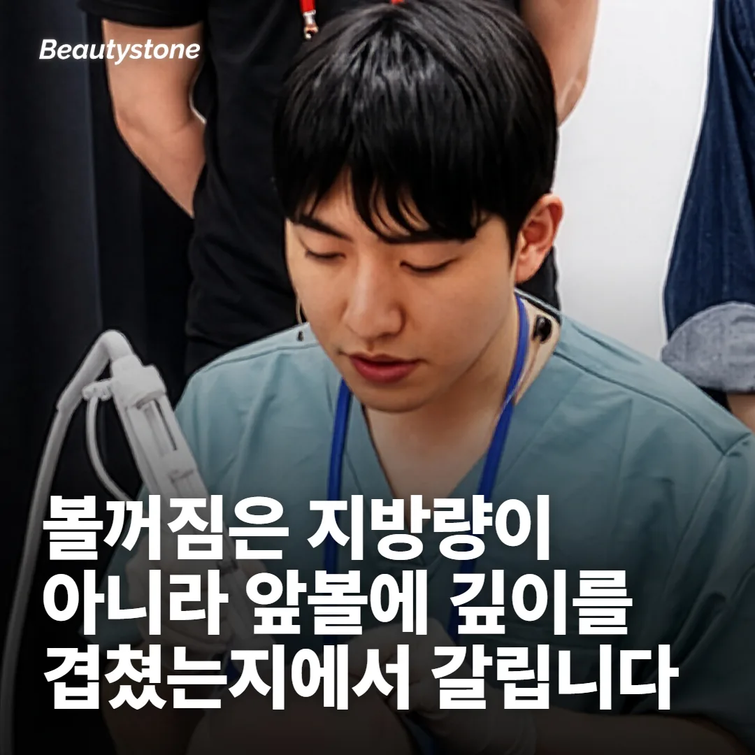 볼꺼짐 걱정은 지방량보다 어디에 겹쳤느냐에서 갈립니다