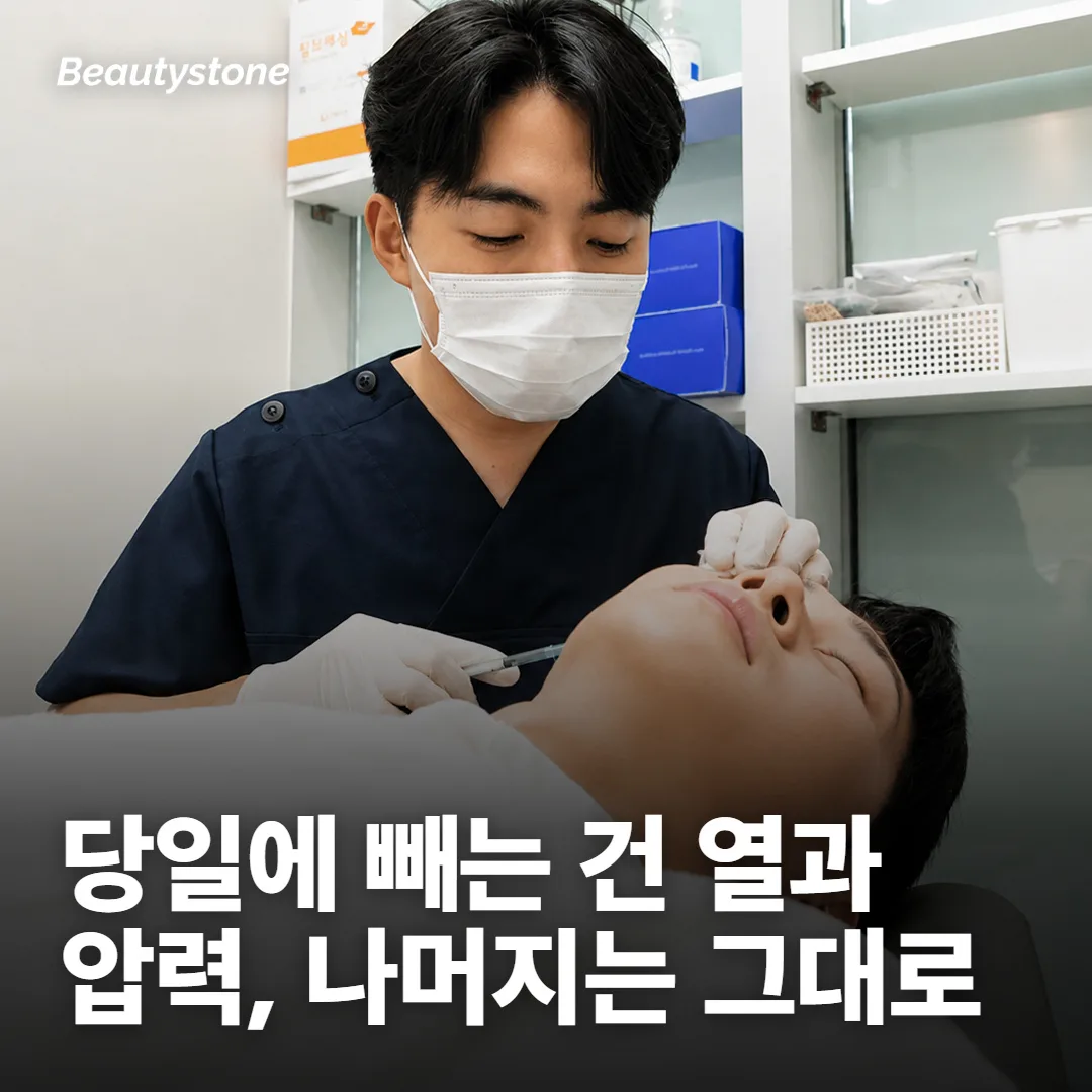 시술 당일: 되는 것과 미룰 것이 꽤 갈려요