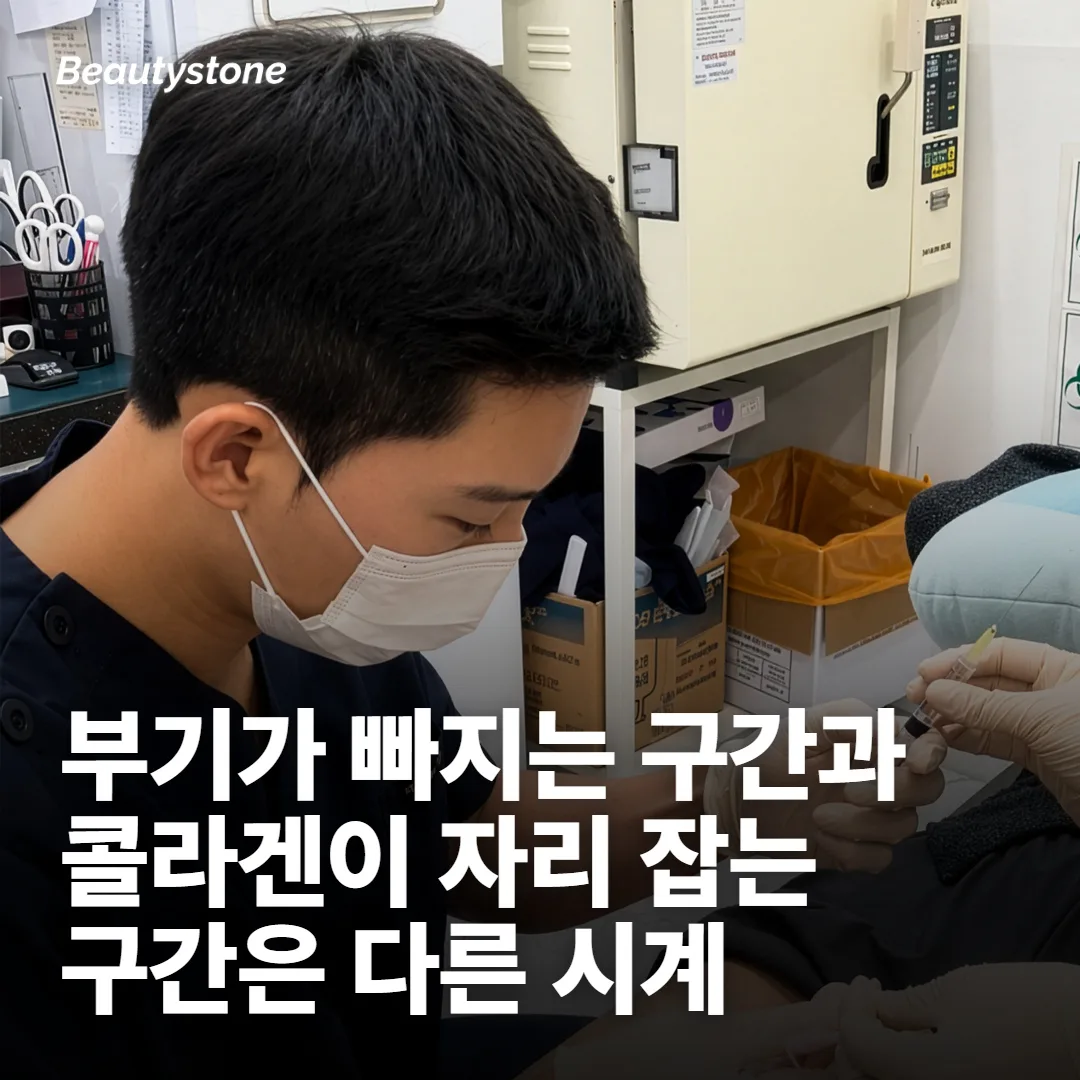 초기에 보이던 게 사라질 때가 판단 시점은 아닙니다