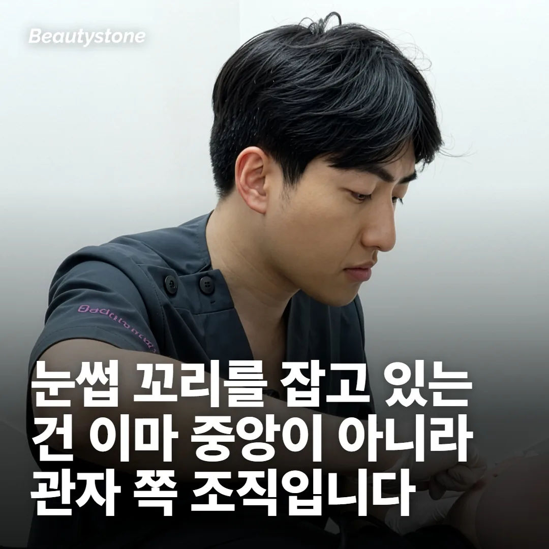 이마만 볼지, 관자와 눈가까지 함께 볼지