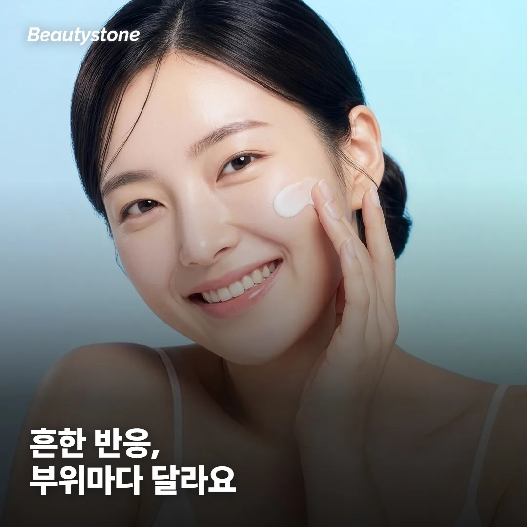 다음 날 더 부었는데, 이게 흔한 반응이에요?