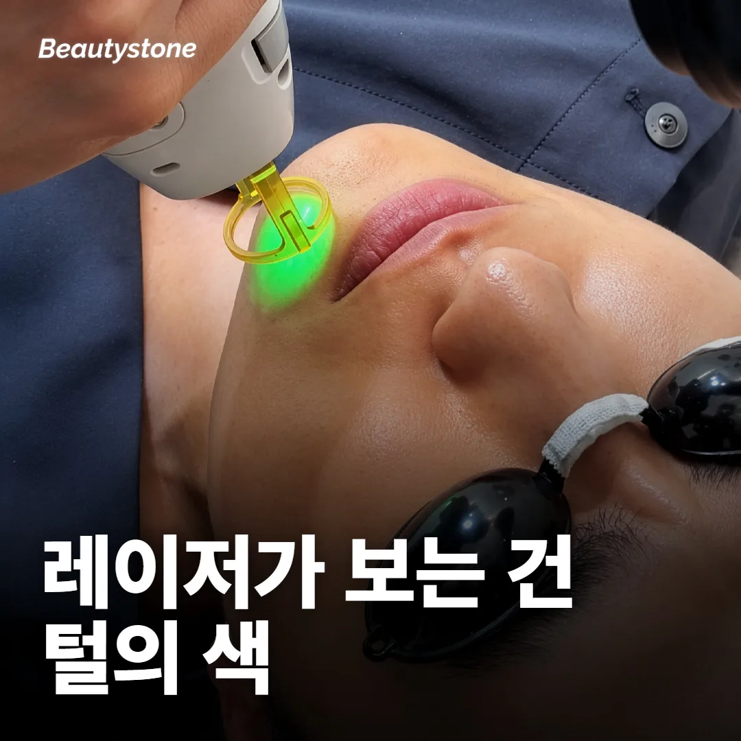 레이저가 먼저 보는 건 털의 굵기보다 색이에요