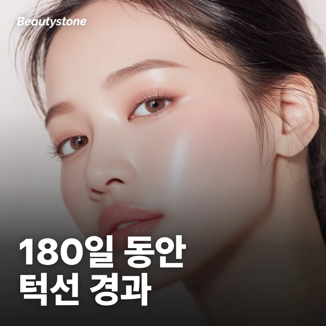180일 동안 따라간 임상시험의 턱선 경과