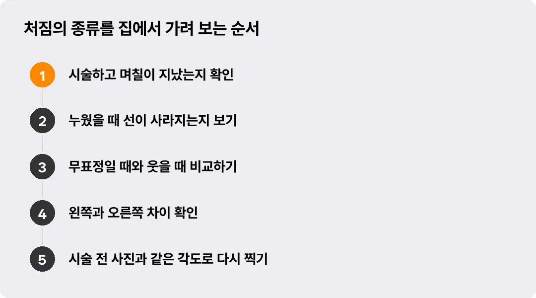 처짐의 종류를 집에서 가려 보는 순서
