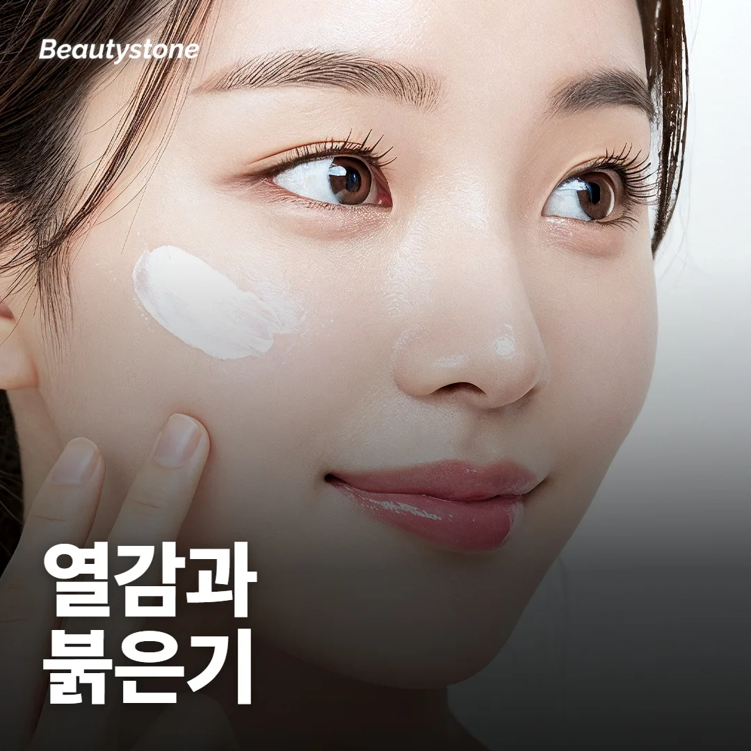 열감과 붉은기, 그리고 드물게 생길 수 있는 일