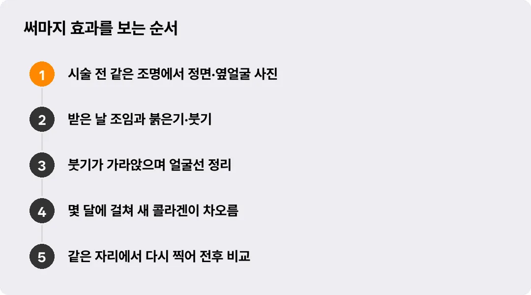 써마지 효과를 보는 순서