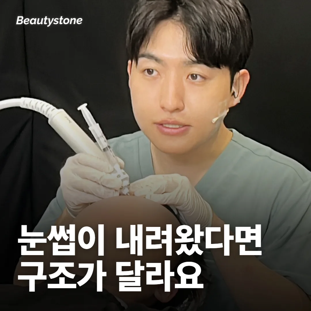 눈썹이 원래 내려와 있다면 보톡스로는 풀리지 않는 문제예요