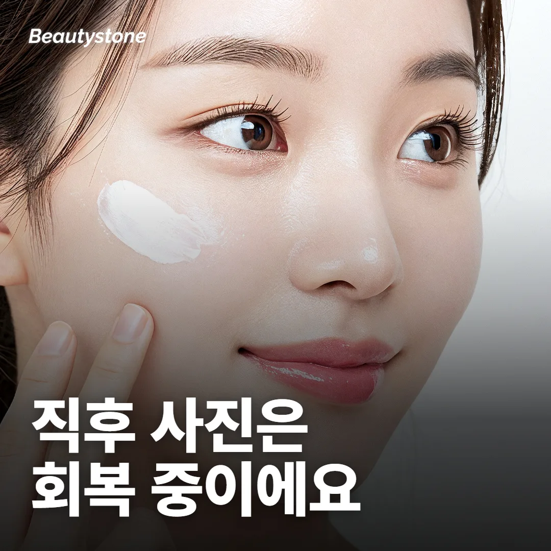직후 사진은 전후가 아니라 회복 중인 사진이에요