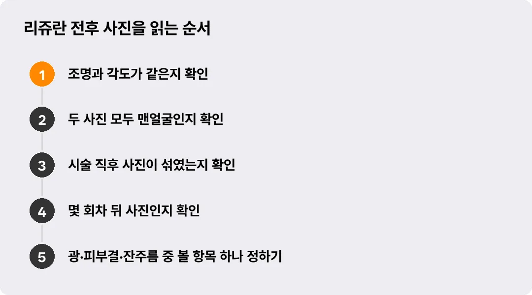 리쥬란 전후 사진을 읽는 순서