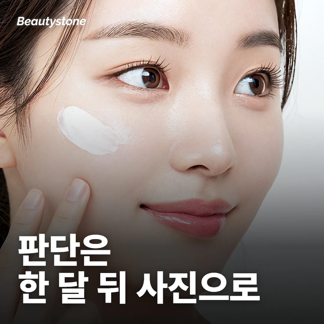 결과는 시술 당일보다 한 달 뒤 사진으로 봐요