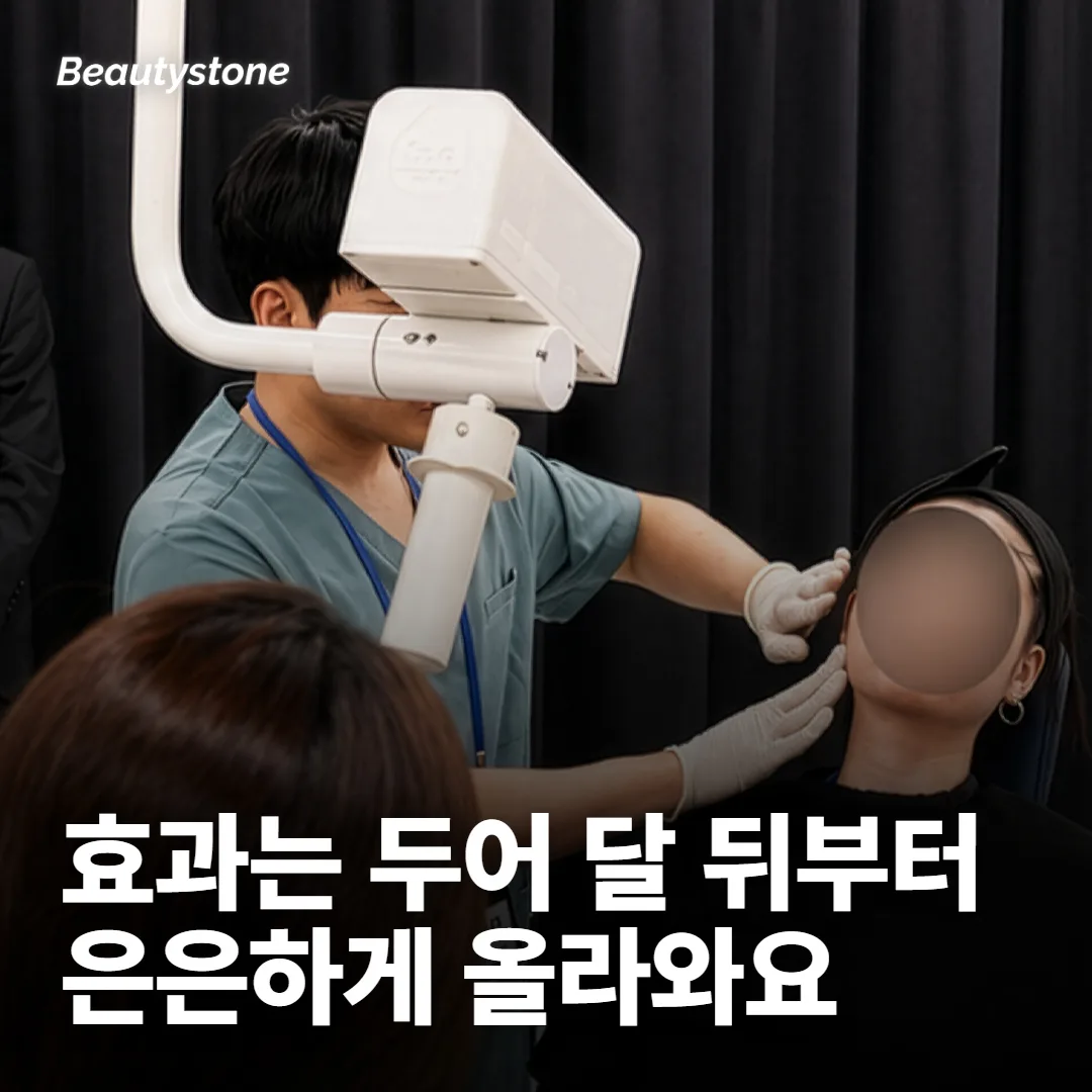 울쎄라 효과는 두어 달 뒤부터 은은하게 보여요