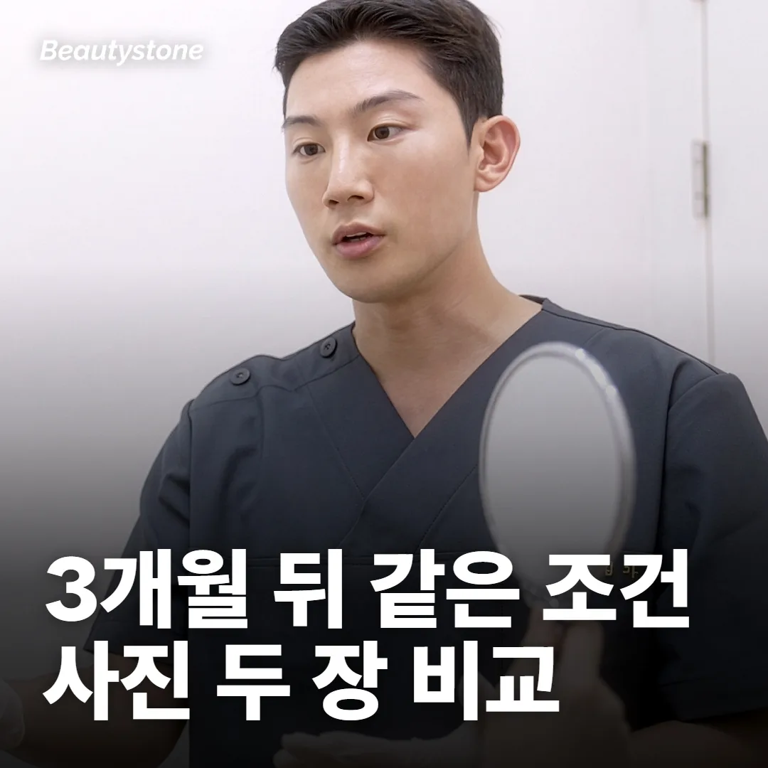 판정은 3개월 뒤, 같은 조건 사진 두 장으로 해요
