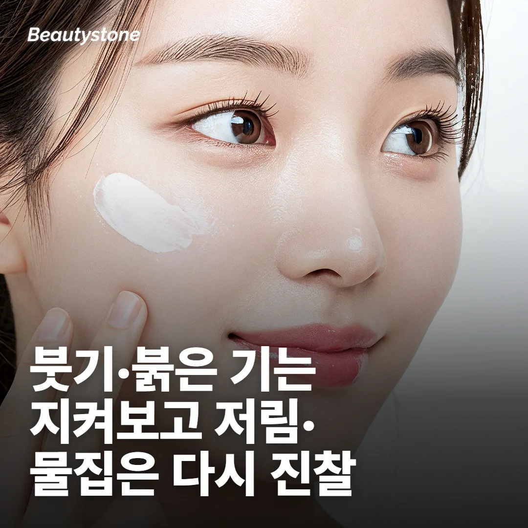 붓기·붉은 기는 지켜보고, 이런 변화는 다시 진찰받아요