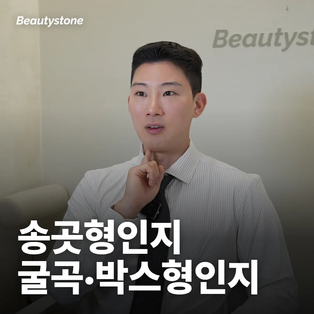 송곳형·굴곡형·박스형, 거울 앞에서 어떻게 나눠 볼까요?