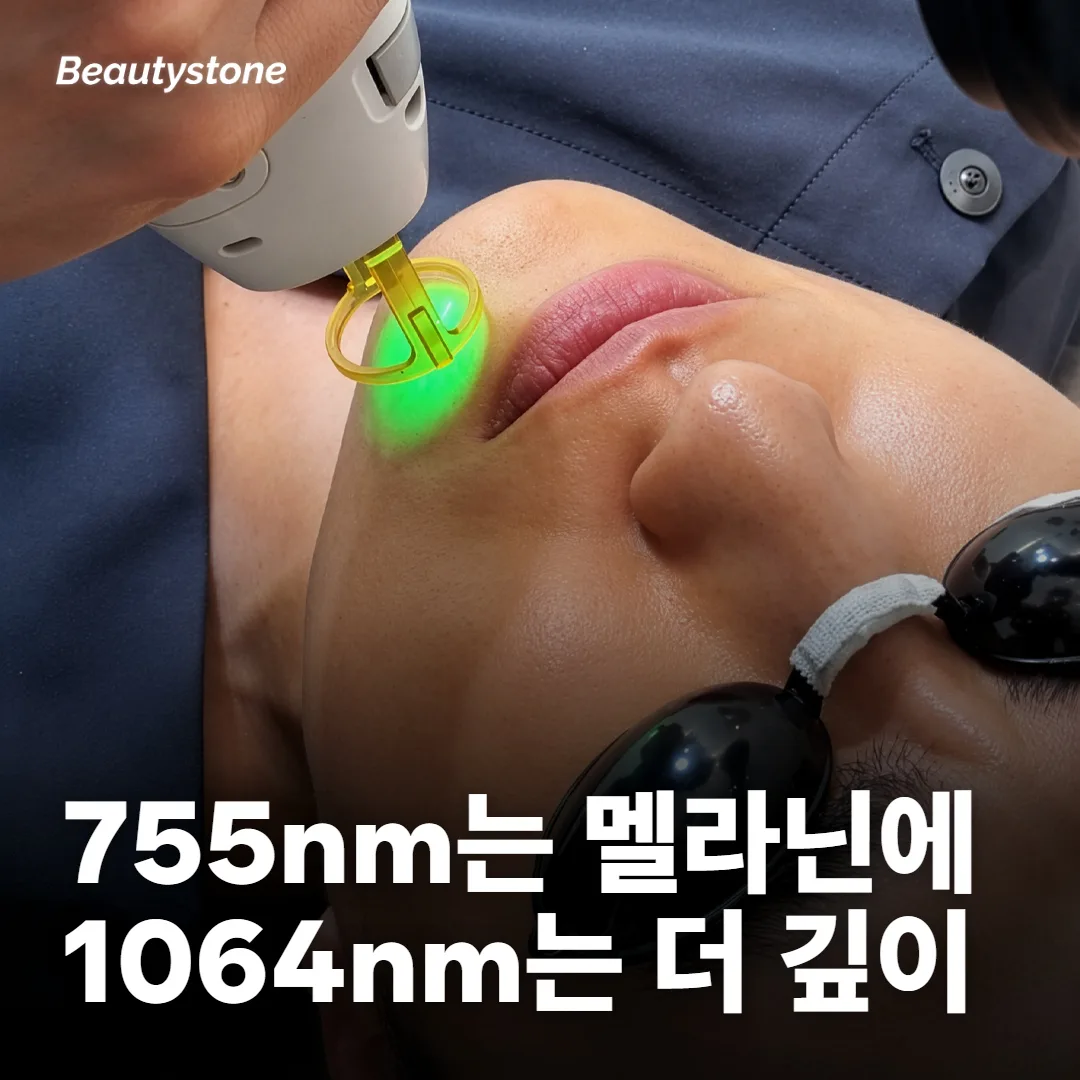 755nm와 1064nm는 털에 닿는 자리가 달라요