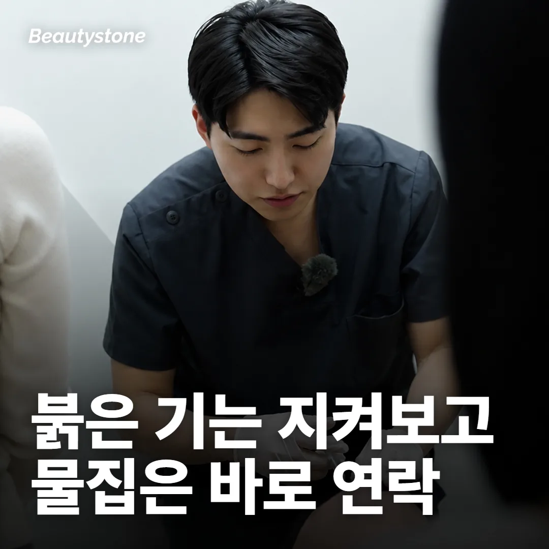 붉은 기는 지켜보고, 물집이나 색 변화는 바로 연락해요