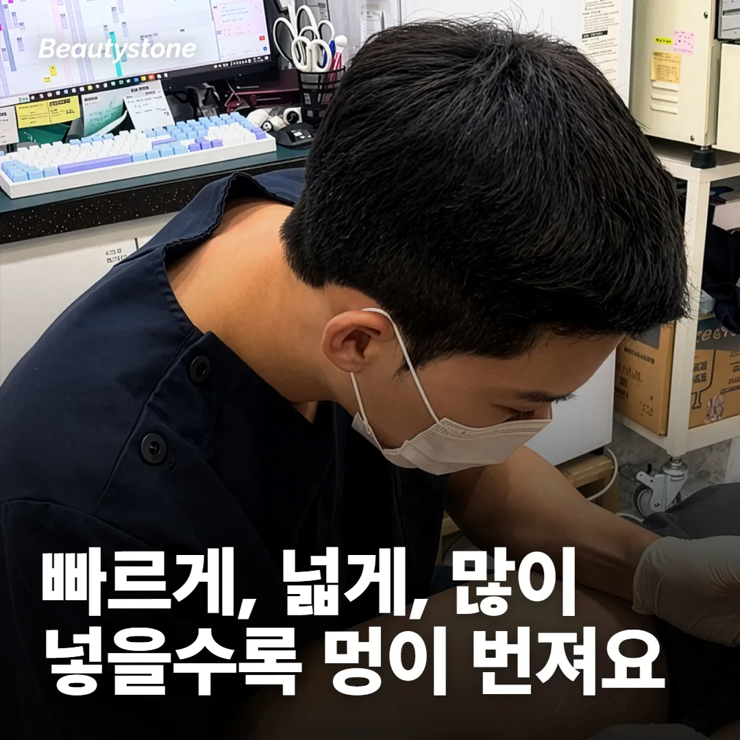 주입 방식: 같은 시술도 넣는 방식에 따라 멍이 달라져요