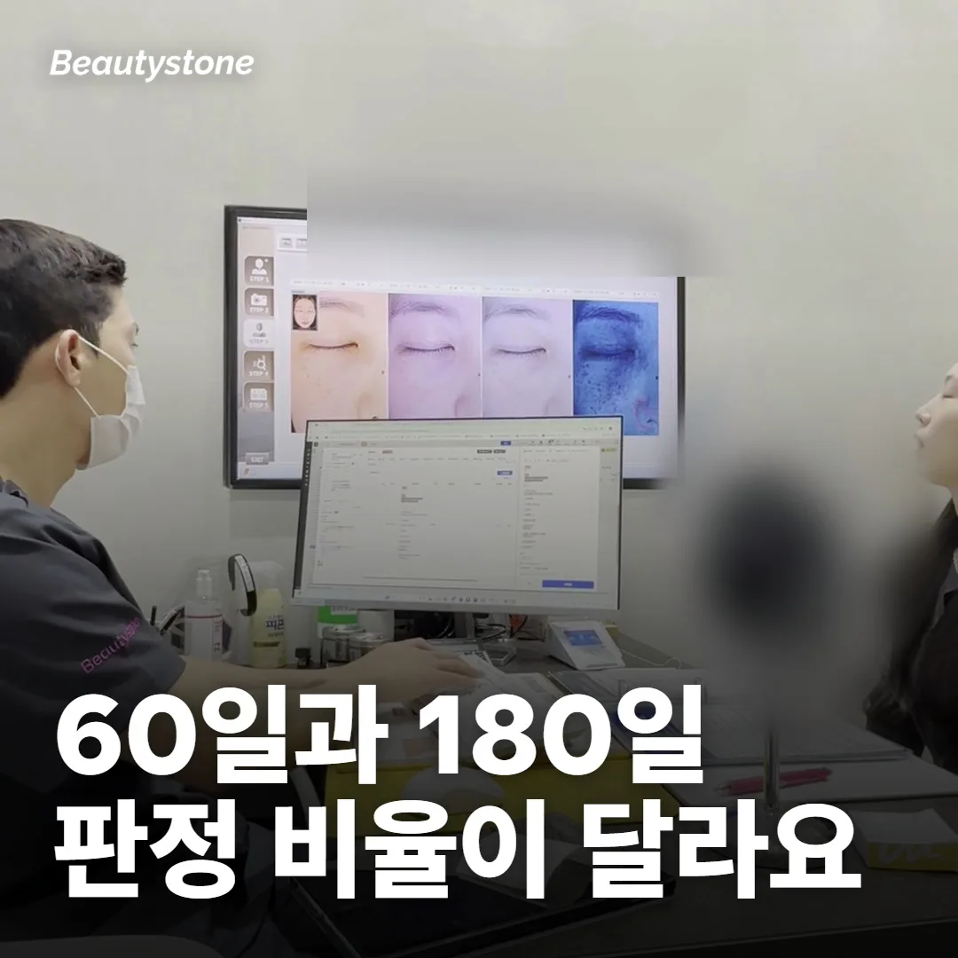 60일째와 180일째, 개선 판정 비율이 크게 달라요