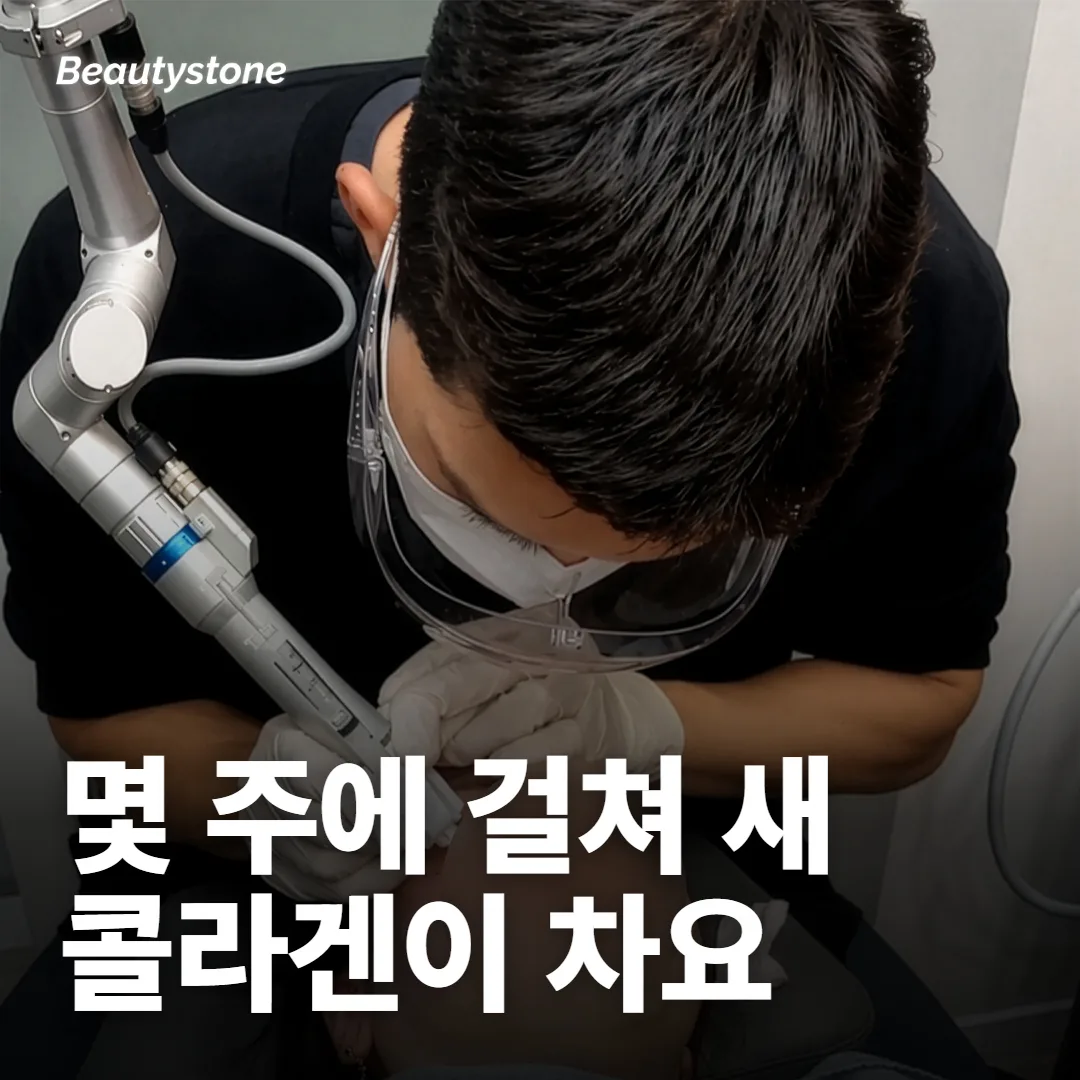 초음파가 닿은 자리에는 몇 주에 걸쳐 새 콜라겐이 차요