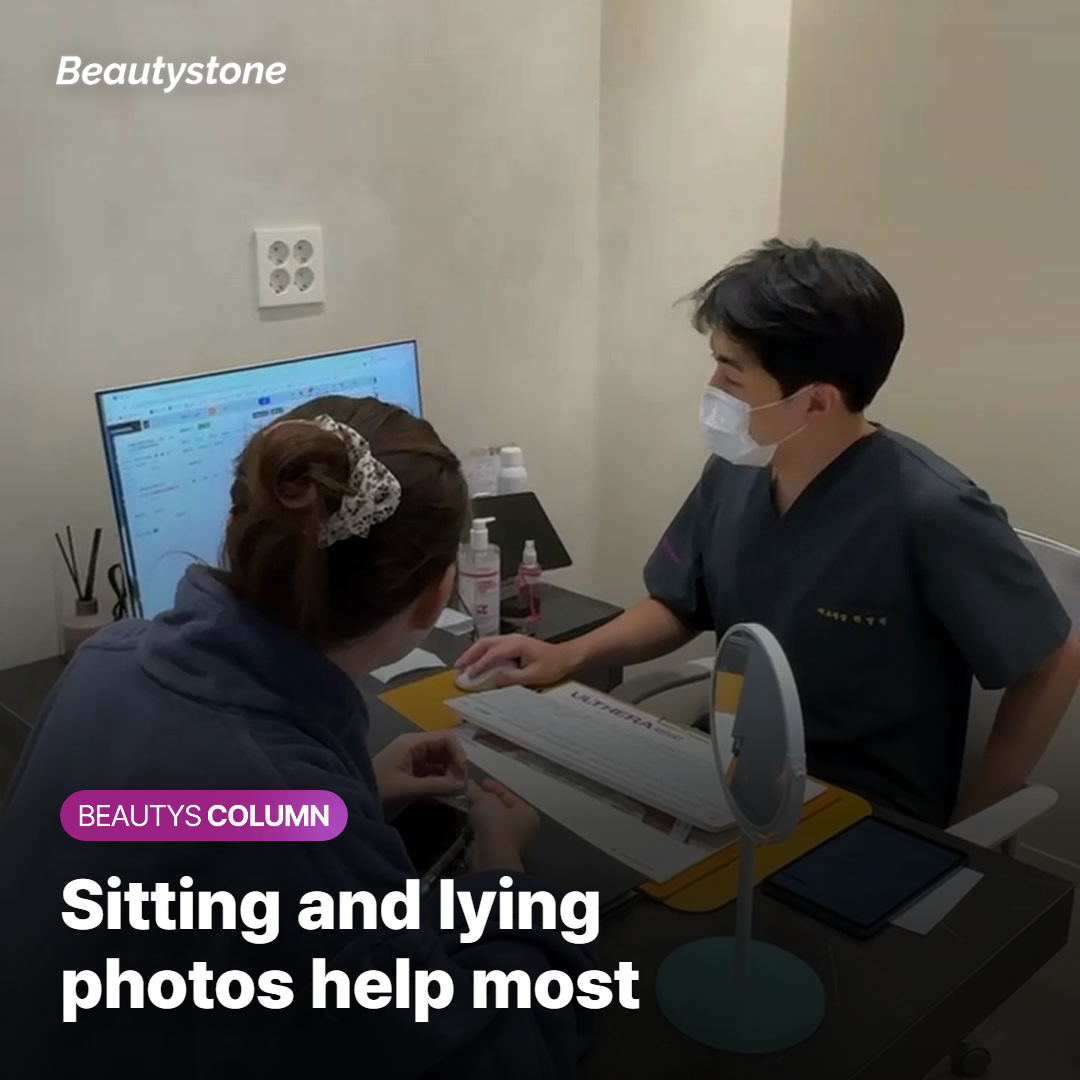Sitting and lying photos to prepare before a side cheek filler consultation